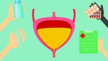 Understanding Urinary Incontinence